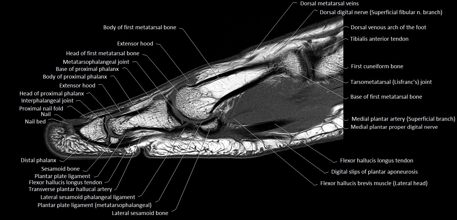 Hallux or big toe sagittal anatomy 3T MRI image 12.webp